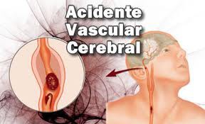 AVC (ACIDENTE VASCULAR CEREBRAL)